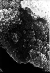 This electron microscope image shows egg-shaped structures, some of which may be possible microscopic fossils of Martian origin as discussed by NASA research published in the Aug. 16, 1996.