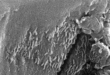 This electron microscope image is a close-up of the center part of photo number S96-12301.