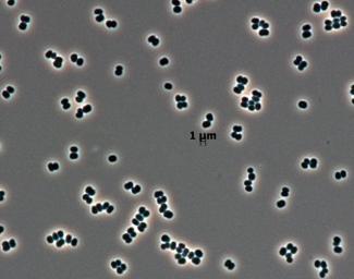 This microscopic image shows dozens of individual bacterial cells of the recently discovered species, Tersicoccus phoenicis, found in only two places: clean rooms in Florida and South America where spacecraft are assembled for launch.