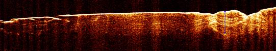 Radar View of Layering near Mars' South Pole, Orbit 1360
